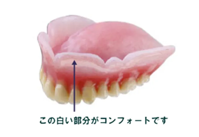 コンフォートデンチャー