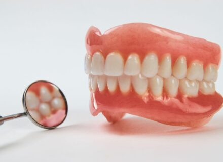 差し歯とインプラントの違いとは？メリット・デメリットも解説