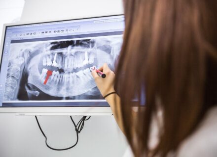 インプラント手術後はどう過ごす？注意点や痛む場合の対処法も解説