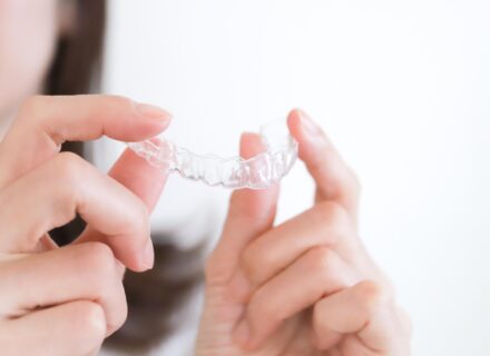 マウスピース矯正の期間はどのくらい？症例別の目安