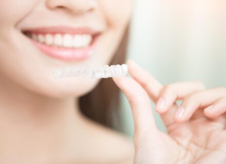 マウスピース矯正で出っ歯は治せる？治療できるケースと判断基準