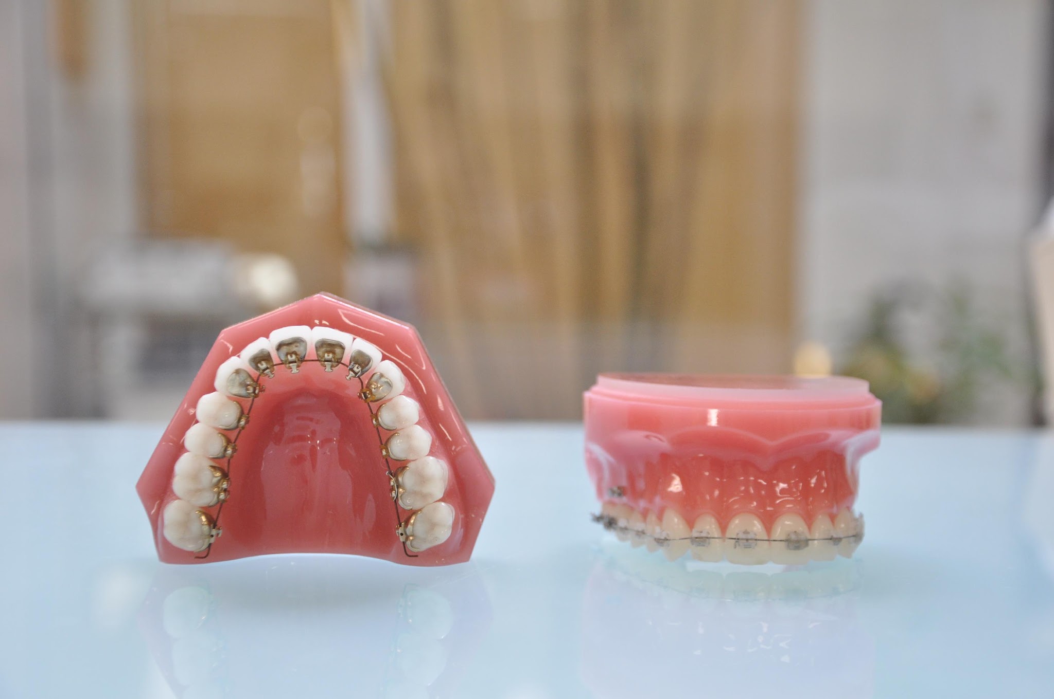 歯の矯正に時間がかかる理由
