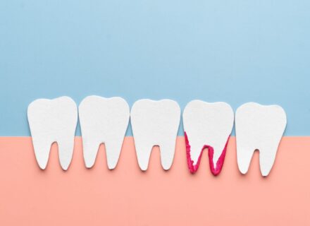 歯周病のズキズキする痛みを和らげる方法と受診の目安